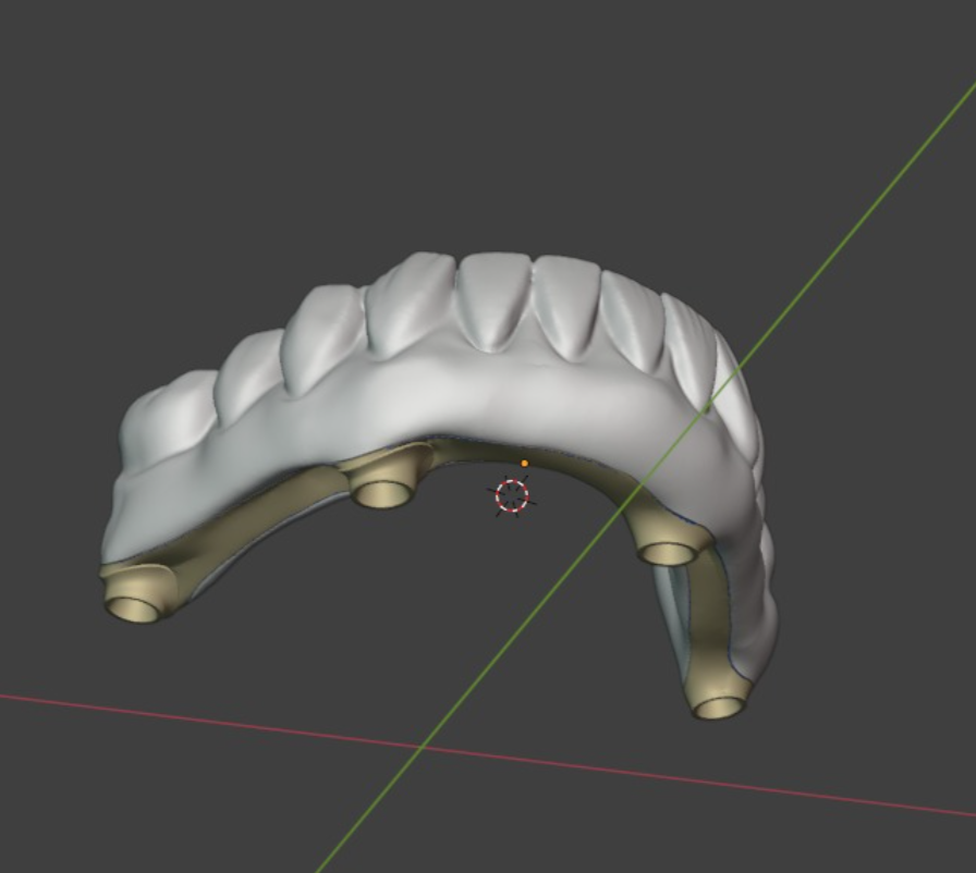 Diseño en Blender de la supraestructura Full Arch sobre sus interfaces de titanio