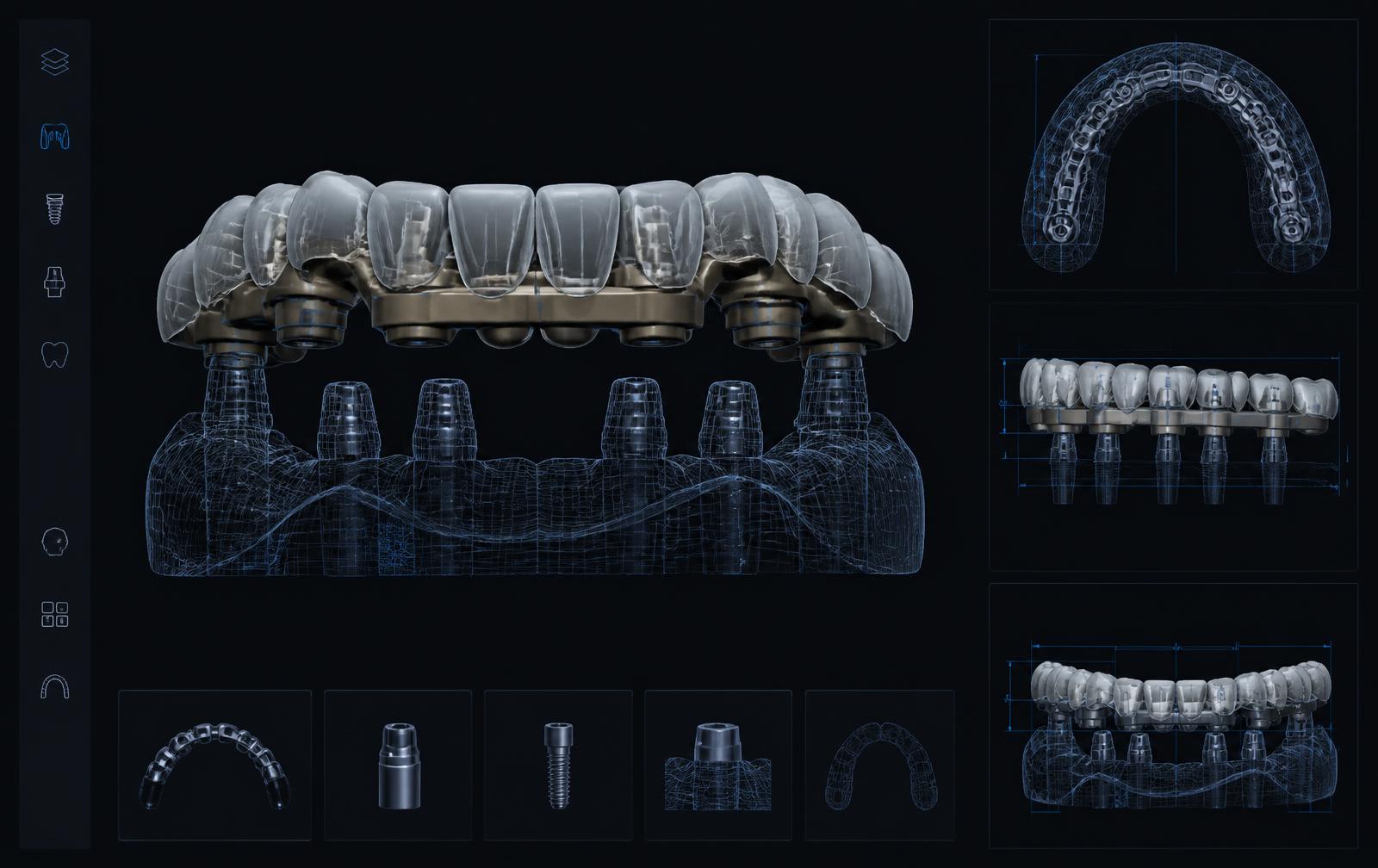 Pantalla de diseño CAD de una estructura protésica sobre implantes