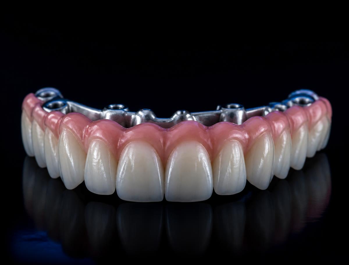 Supraestructura de zirconio con dientes y encía rosa